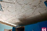 В саратовском минздраве рассказали о состоянии обгоревшего от опытов со спиртом подростка 